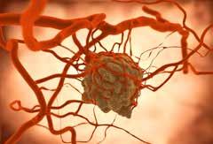 9 Malignome Bei der Prophylaxe des Prostatacarcinoms scheinen Patienten mit hohen EPA- DHA-Spiegeln weniger häufig zu erkranken.