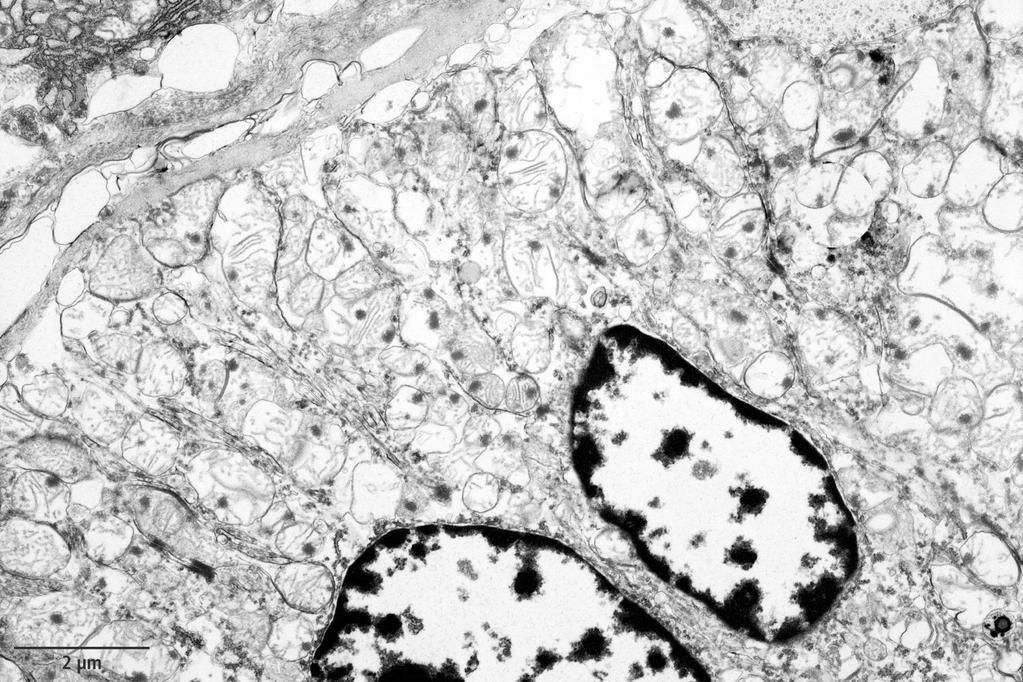 Abbildung 5.1: Streifenstückzellen mit zahlreichen Mitochondrien und intramitochondriale Einschlüsse ( woollen densities ) in der Gl.