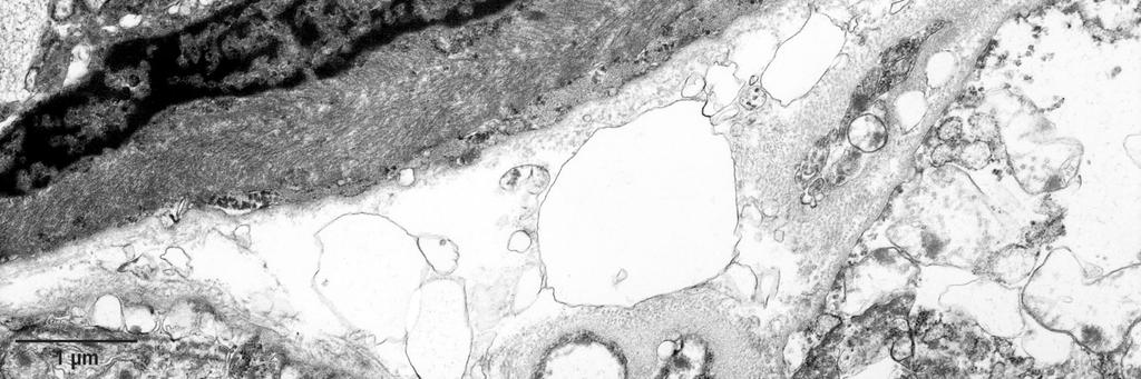 Zwischen den Zellen der Endstücke sind tight junctions zu beobachten. Die basale und laterale Plasmamembran bilden Desmosomen aus.