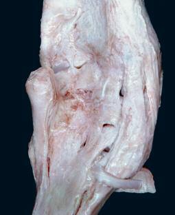 3 Vorder- oder Schultergliedmaßen Karpalgelenk Rind Lig. collaterale mediale Lig. accessoriometacarpeum Sehne des M.
