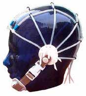 20 Universal EEG-Hauben Bei Universal EEG-Hauben nach dem internationalen 10/20-System, wie TerniMed, Nihon Kohden und Schwarzer EEG-Hauben, ist das Gitternetz komplett verstellbar und somit