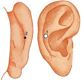 10 2 Anatomie/Reflexzonen am Ohr Seite am Ohr, auf der sich das Organ bzw. der Störherd auch am Körper befindet (z. B. Appendixnarbe rechts usw.).