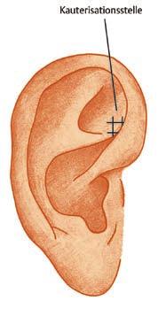 links. Übergeordnete Punkte sind in der Lokalisation abhängig von der Händigkeit des Patienten. Das Ohr auf der Seite der Händigkeit nennt man auch das dominante Ohr.
