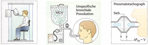 Unspezifische bronchiale