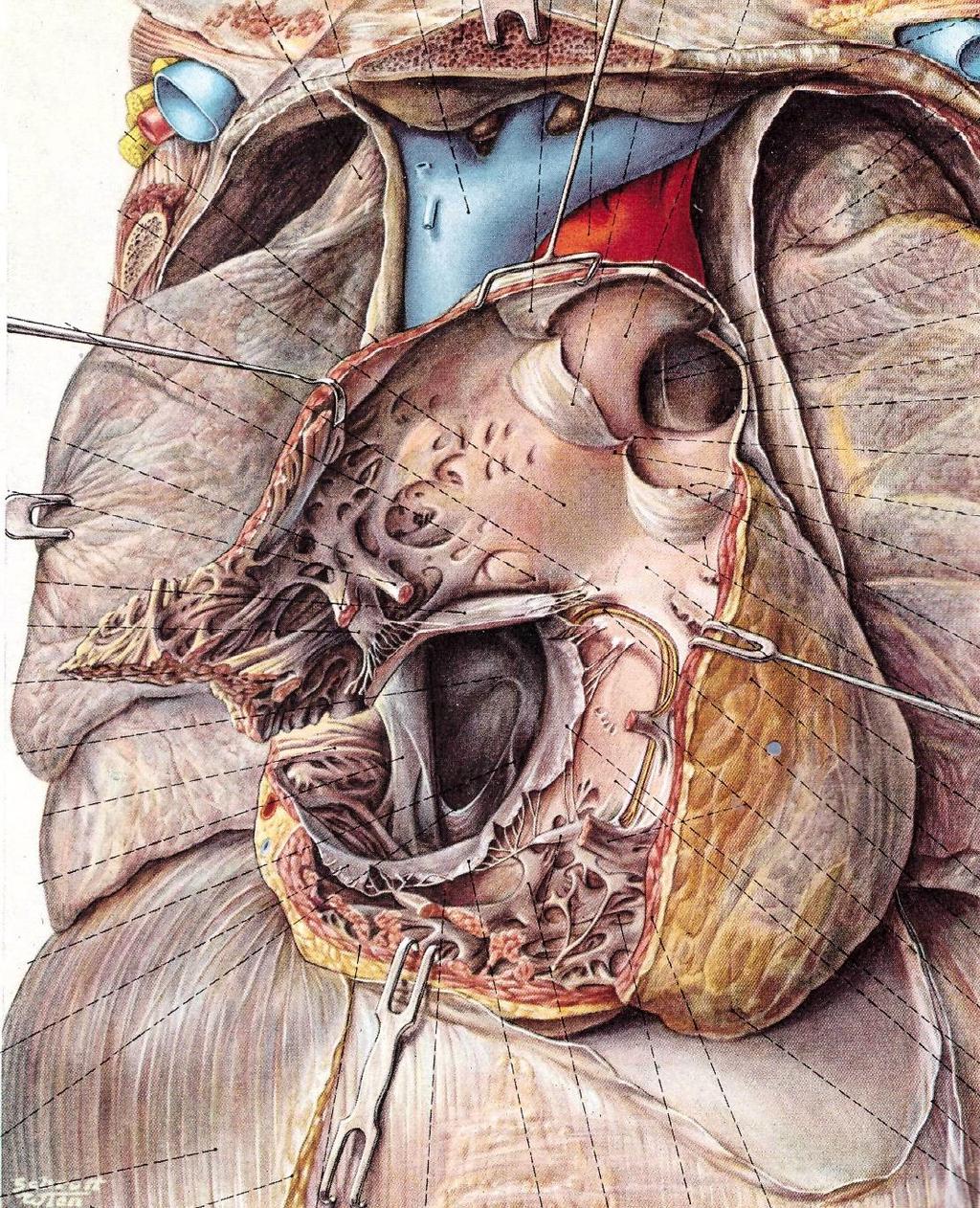 Das rechte Herz Rechter Ventrikel: Infundibulum Trabeculae carneae Crista supraventricularis