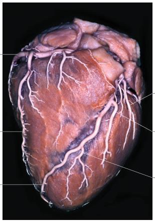 anterior: Rami