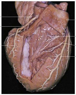 Ramus interventricularis anterior: Rami