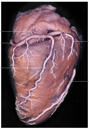 coni arteriosi, Ramus