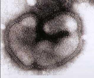 Allgemeines zu Influenza-Viren Definition Influenza Viruskrankheit des Atmungstraktes