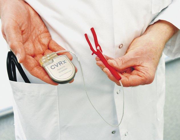 6 Medizin & Technik» Kardiologie «Management & Krankenhaus 3/2013 Rezeptoren stimulieren den Blutdruck Bei schwer einstellbarem Bluthochdruck zeigt die Baroreflexstimulation der Nerven in den