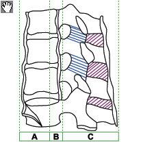 Einleitung 1.4 Drei-Säulen-Modell nach Denis Zu der vollständigen Frakturklassifikation gehört die diagnostische Bildgebung. Für eine korrekte Darstellung der Knochen eignen sich das Röntgen- bzw.
