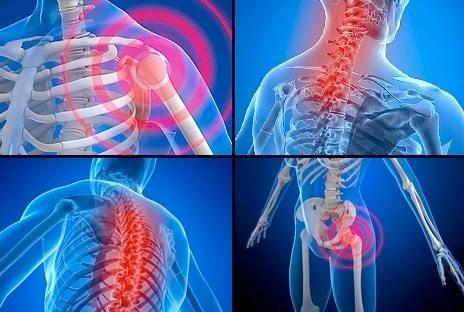 3 FIBROMYALGIE EINE WEN BING LUN ERKRANKUNG Fibromyalgie (Faser-Muskel-Schmerz - FMS) ist durch weit verbreitete Schmerzen mit wechselnder Lokalisation in der Muskulatur, um die Gelenke und
