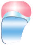 Wenn die gewünschte Farbe feststeht, wird die erste Dentinschicht um zwei Farbtöne dunkler gewählt. Beispielsweise wird für A1 als erste Dentinmasse genutzt.