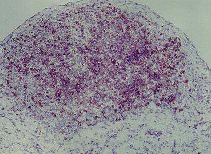 T-Zellen und B-Zellen H&E
