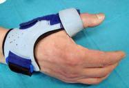 Wichtig: Eine schwere Belastung der betroffenen Hand sollte in den ersten drei Monaten nach der Operation nicht erfolgen.