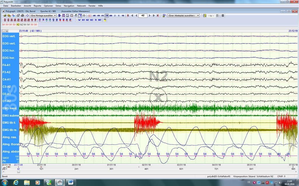 Kardiorespiratorische Polysomnographie EEG EOG EMG Atmung oronasal thorakal abdominal EKG