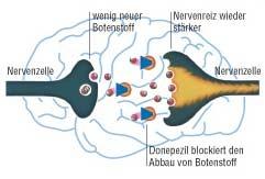 Gehirn + Transmitter