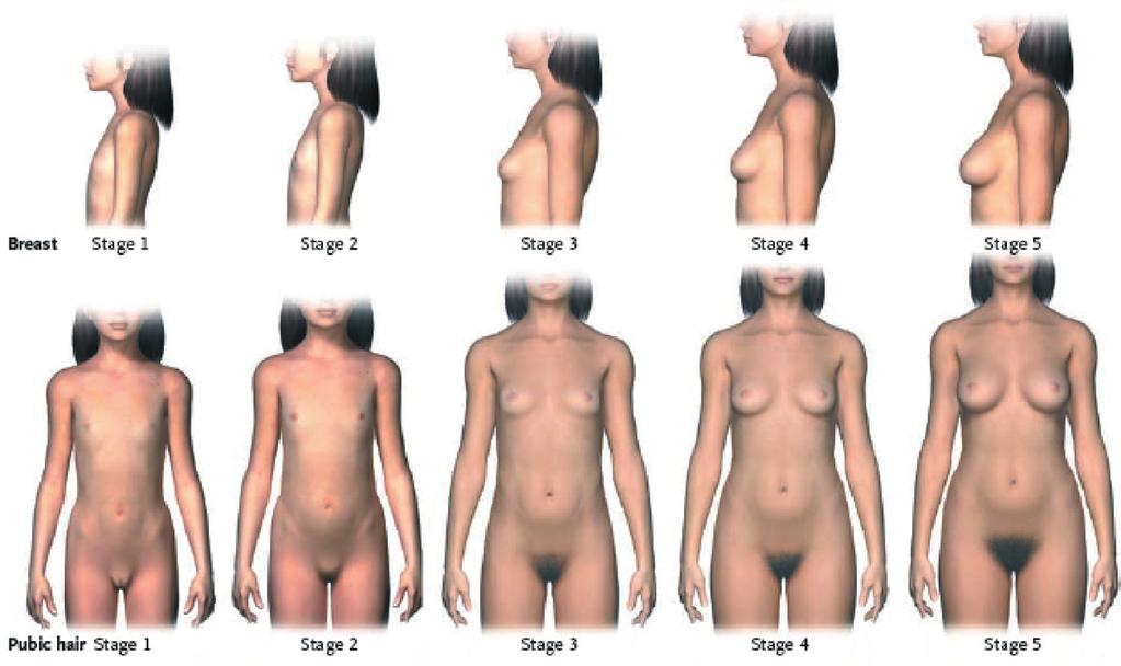 1.2 Normale körperliche Pubertätsentwicklung Die körperlichen Veränderungen während der Pubertätsentwicklung werden durch die Einteilung nach Tanner (Abb. 3 und 4) beschrieben.