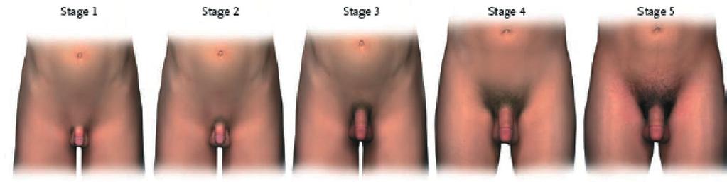 B 4 Die Brustgröße nimmt zu, Mamille und Areola heben sich von der Brustkontur ab.