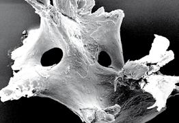 klinischen Erfolg boviner Knochenregenerationsmaterialien bedingen: - Phasenreines Hydroxylapatit ohne organische Anteile Diese Eigenschaften sind die