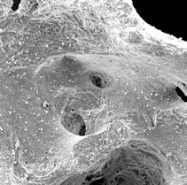 von Zellen, Proteinen und Blutgefäßen Rasterelektronenmikroskopische (REM) Aufnahmen zeigen die hochstrukturierte Oberfläche von sowie Makro- und Mikroporen.