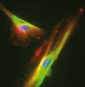 Immunfluoreszenzfärbung einer Stammzelle Maximale Stabilität und hervorragende ossäre Integration von Histologische Studien an Druckkraft (N) 1670±1 4510±770 Druckfestigkeit (N/cm 2 )