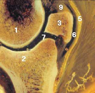 H. E. König et al. (1992) werden zwei Gelenkflächen des Strahlbeins berücksichtigt, eine proximale zum Kronbein und eine distale zum Hufbein.