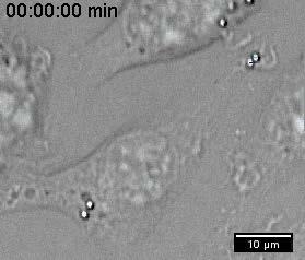 Größenabhängiger Transport in Zellen Partikel mit 3 µm