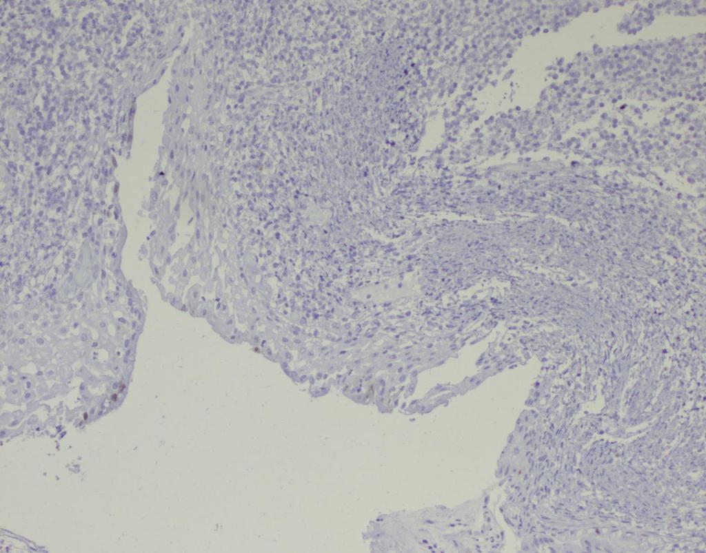 Histologie Konisat p16