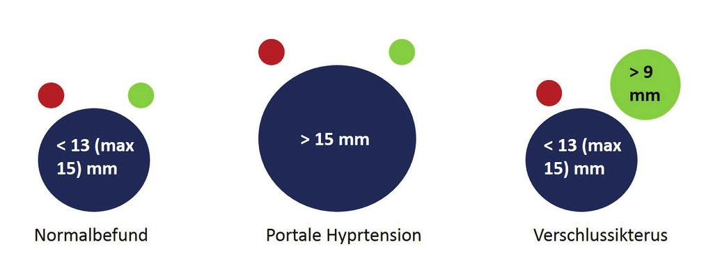 Klinik: Ein Querdurchmesser der Vena portae von > 15 mm deutet auf eine portale Hypertension hin. Der gesunde Ductus hepatocholedochus sollte im Durchmesser < 6 mm sein.