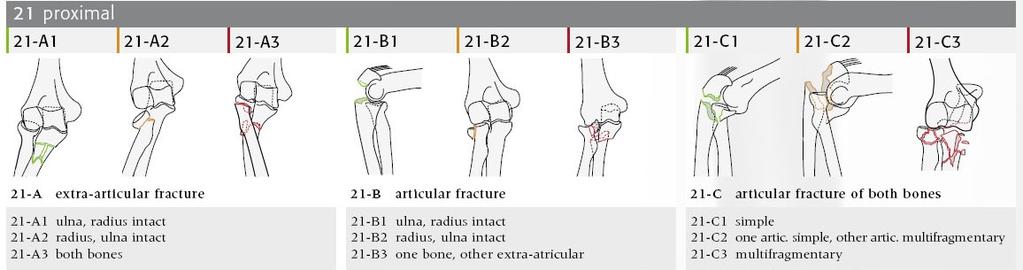 Allgemeiner Teil 1.11 Knöcherne Verletzungen des proximalen Radius Klinisch unterscheidet man folgende Frakturen des Radius: I. Radiusköpfchenfrakturen (oft Gelenksverletzung) II.