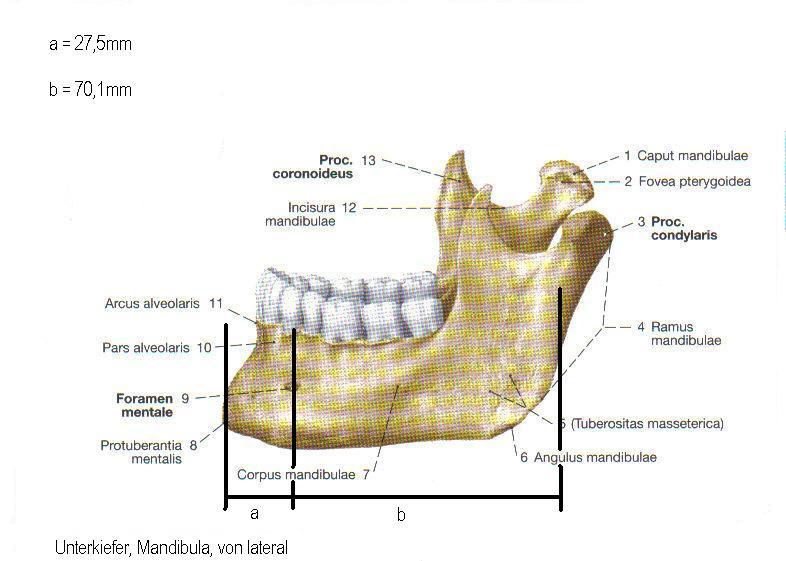 Abbildung.23 Unterkiefer, Mandibula, von lateral (Quelle Sobotta) In 49 % der Fälle ( 98 Köpfe ) lag das Foramen mentale symmetrisch.