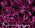 01, ESBL producer Klebsiella pneumoniae 52, ESBL producer Method The antimicrobial activity was evaluated in a
