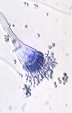 Schimmelpilze mikroskopisch Aspergillus