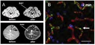 1: Mouse spleen, nanolabelled in vivo. X-Ray fluorescence imaging at DORIS, DESY Fig.