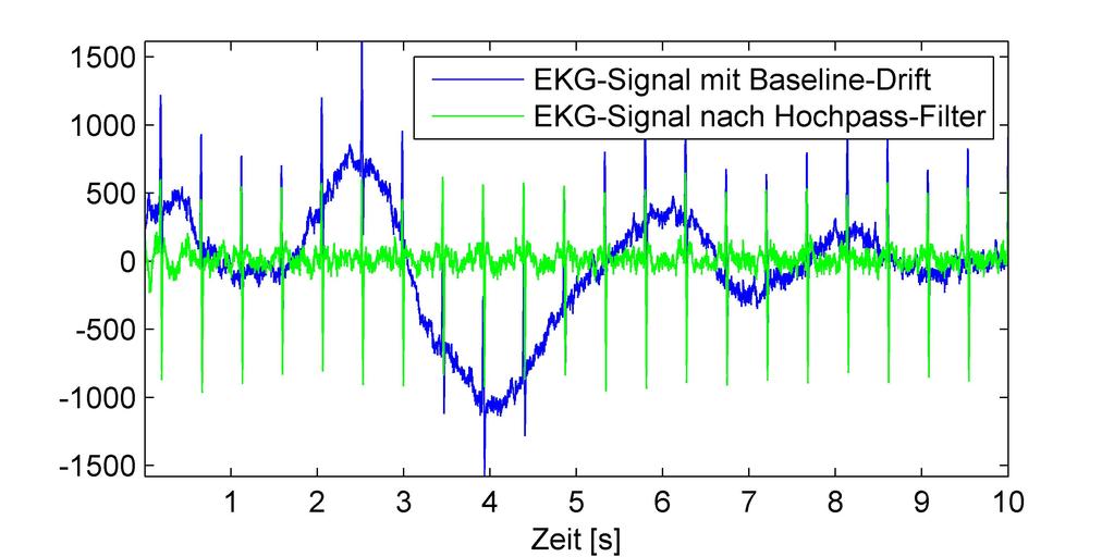 Ziel: Reverse-Engineering für Digitale Filter Einführung der Reverse Engineering Beispielanwendung: EKG-Signal 1 mit Baseline-Drift 1 Goldberger AL, Amaral LAN, Glass L, Hausdorff JM, Ivanov PCh,