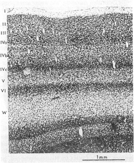 Primärer visueller Cortex V1, area 17, area striata (gestreiftes Areal) 6 Schichten Erhaltung retinotoper Organisation Aber: das den Foveabereich