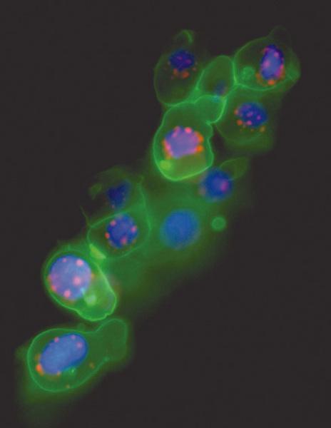 Die spezifische Expression eines fluoreszierenden Proteins in den Keimzellen ermöglicht es, dynamische Prozesse innerhalb der Keimzelle zu verfolgen (z. B.