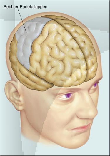 Von Dichotomien zu Beziehungen und Interaktionen Komplexe psychologische Veränderung durch Schädigung: (Asomatognosie!