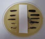 Staphylococcus aureus (Bakterium) Mit bakteriostatischer Ausrüstung ist kein Bewuchs Ohne