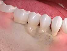 Wie können Zahnfleischerkrankungen behandelt werden?
