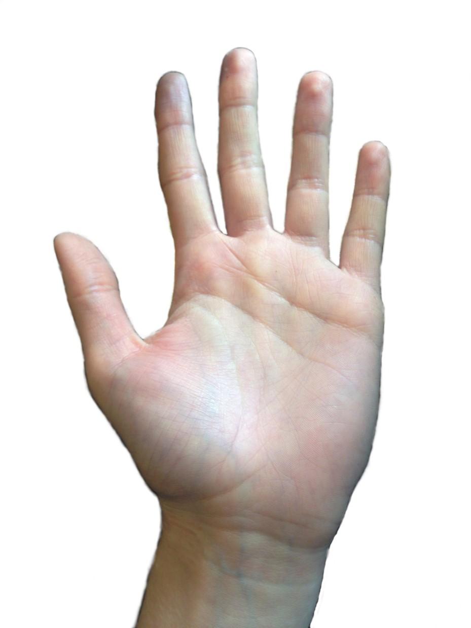 2 ANATOMISCHER HINTERGRUND 2.1 Oberflächenanatomie der Hand Die Kenntnis der Oberflächenanatomie der Hand ist essenziell für die Orientierung und zur Auffindung des RF.