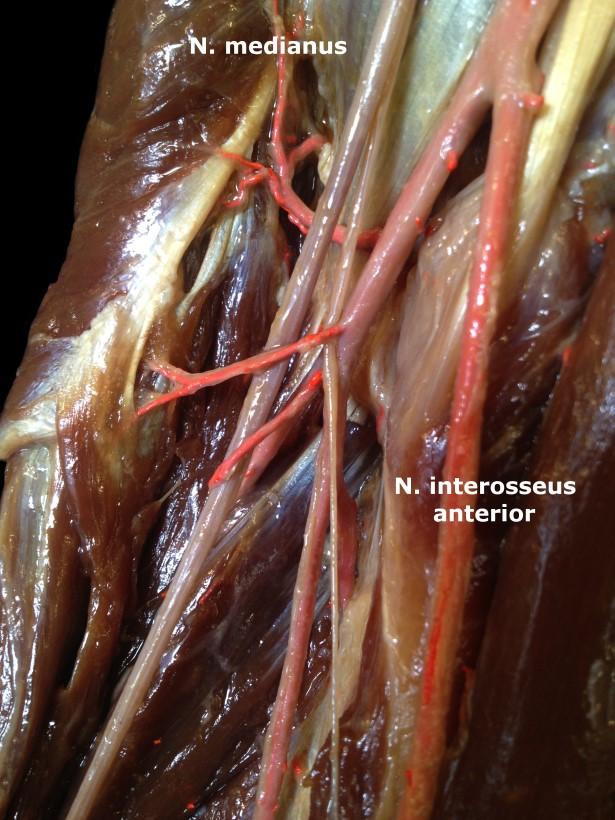 medianus zunächst lateral der Arterie, liegt dann im Bereich der Mitte des Oberarms ventral von ihr und kommt in der Cubita medial des Gefäßes zu liegen.
