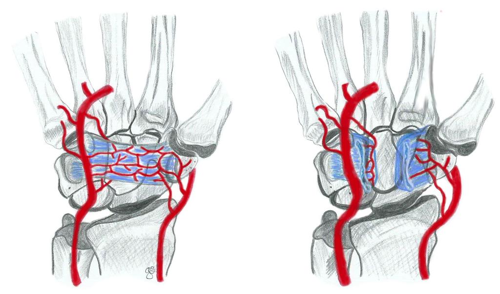 Abbildung 11: Vaskuläre Versorgung im Bereich des Handgelenks 2.4.4 Anastomosen Im Bereich des Oberarms kann der N. medianus Anastomosen zum N. musculocutaneus sowie zum N. ulnaris aufweisen.