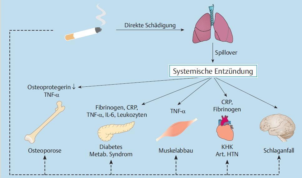 COPD: Systemische Entzündung und Komorbiditäten Modifiziert nach Greulich et al.