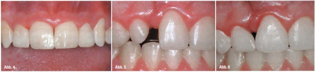 Fachbeitrag_ Komposits evidenzbasiertes Handeln die Voraussetzung für eine zeitgemäße Zahnmedizin.