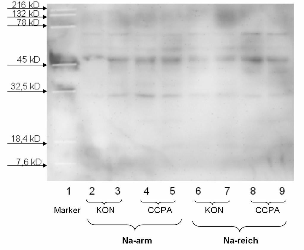 4 Ergebnisse Abbildung 52: Western Blot für A 1 -Rezeptor-Protein, Extraktionen ganzer Nieren Bahn 1: MW-Marker von Bio-Rad (pre-stained) Bahn 2 und 3: NaCl-arme Diät (Kontrolle) Bahn 4 und 5: