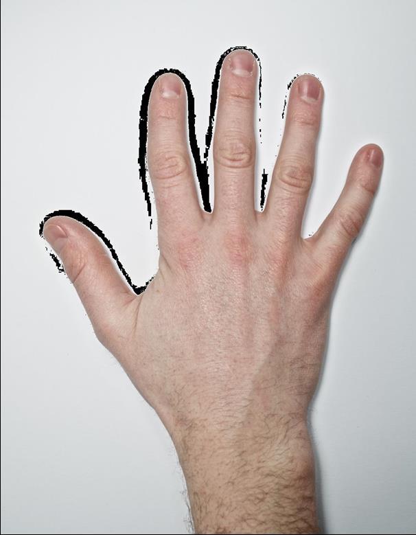 Kognitive Verhaltenstherapie bei primärer Insomnie unter Berücksichtigung von Achtsamkeit und Bewegung 257 Sehen Sie sich das Bild der Hand für ca. vier Minuten an.