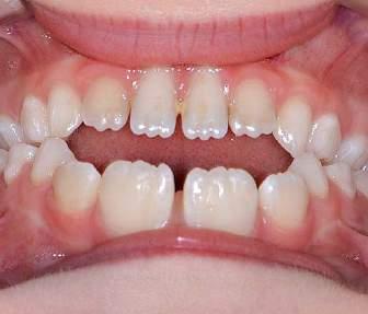 474 Aus Nordrhein Moderne KfO: Was sollte der Zahnarzt wissen?