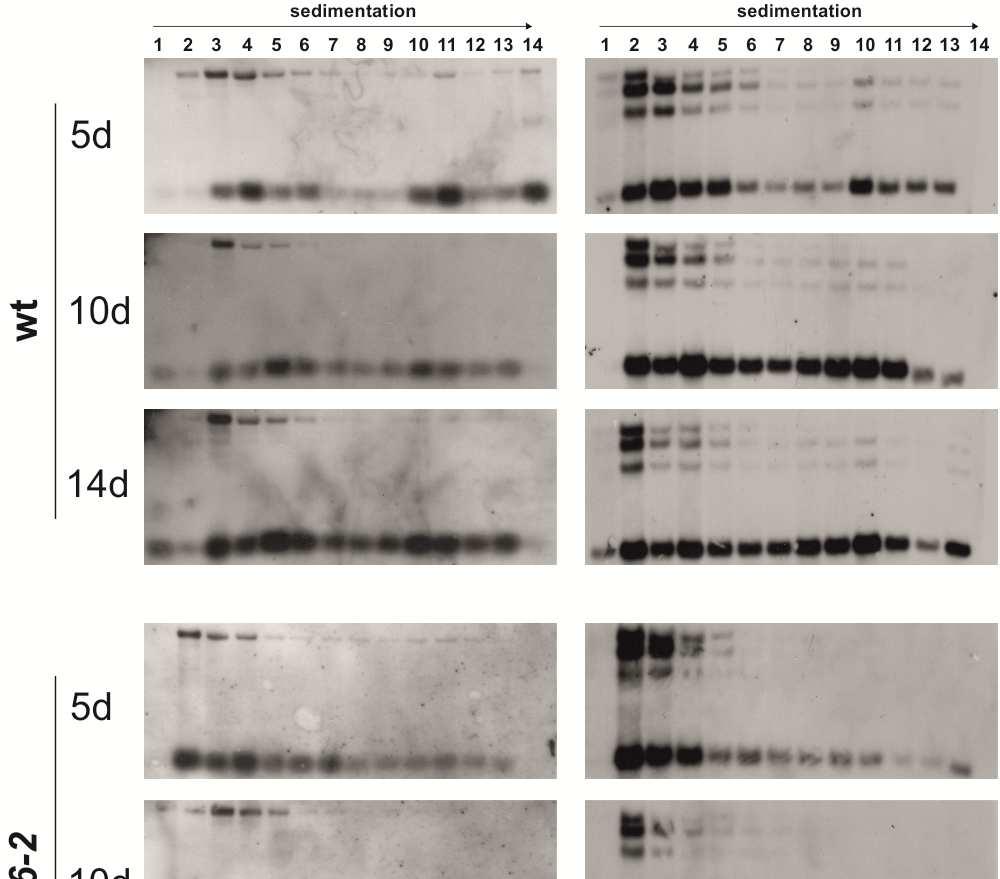 Ergebnisse Abb.17: Analyse polysomaler rrna. Northern Analyse der polysomalen Fraktionen mit Sonden gegen rrn4.5 (links) bzw.